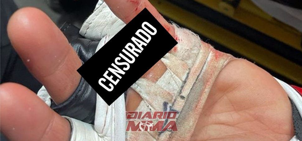 Dedo Finger CFFC 94 Diario MMA