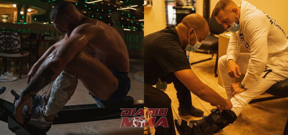 Conor McGregor lesión