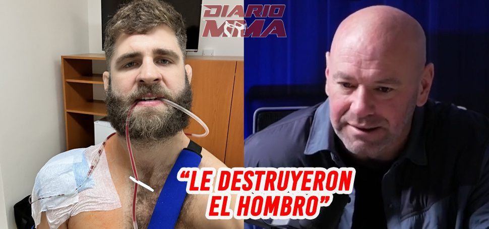 Dana White Jiri Prochazka hombro